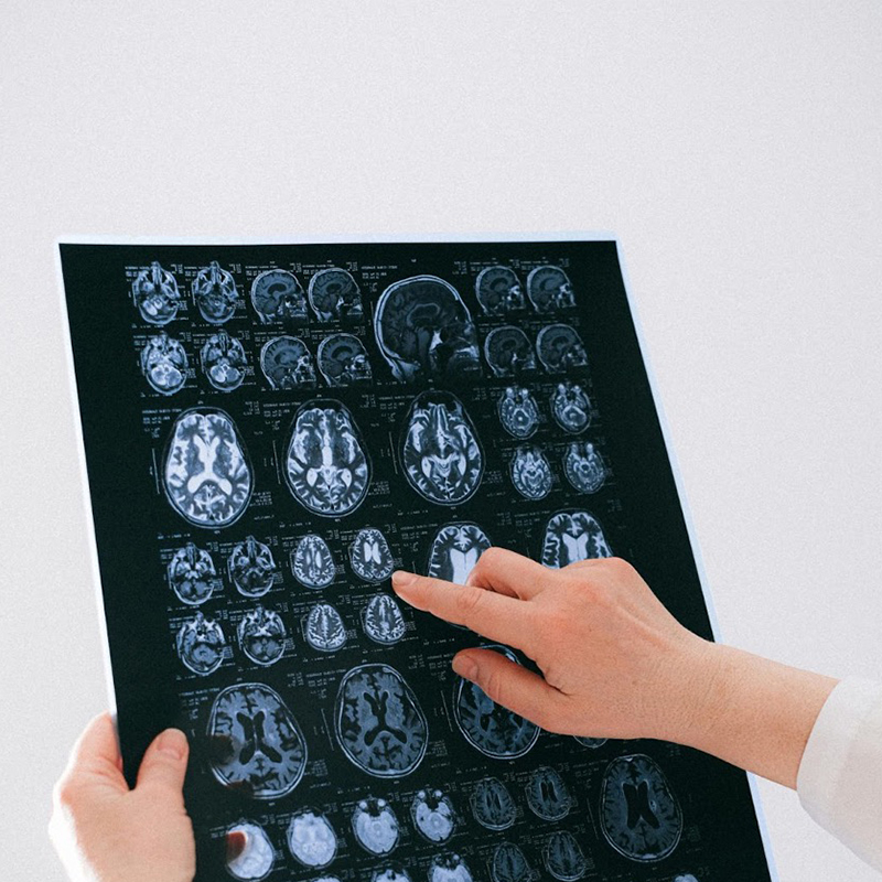  Imagen Investigación revela un importante descubrimiento en la comunicación del eje intestino-cerebro noticia